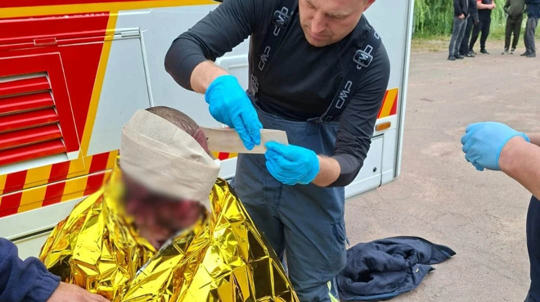 ДСНС підтвердила наслідки нічної атаки на агропідприємство на Житомирщині